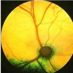 Retina normal